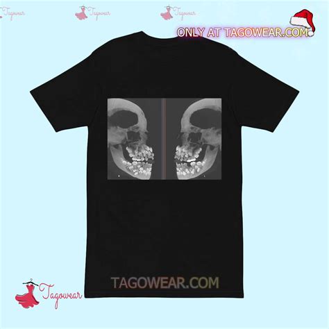 An X-ray Of A Person With A Severe Case Of Hyperdontia Shirt - Tagowear