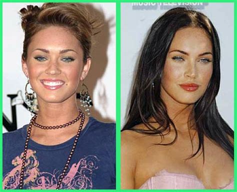 Plastic Surgery Before And After: Megan Fox Before And After