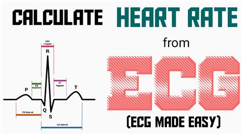 Calculation Of Heart Rate From Ecg Ecg Made Easy Ecg Lecture Part 3 Ekg Youtube