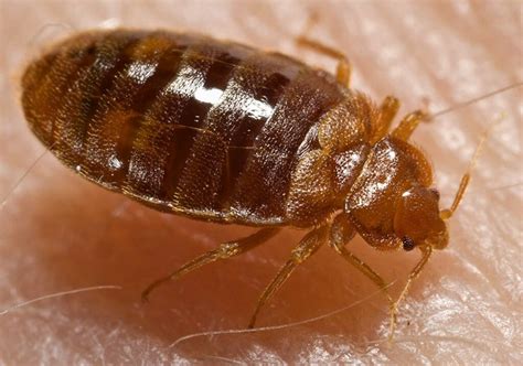 Bed Bugs vs. Scabies: What's the Difference? | ESS Universal