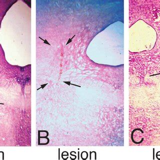 Histological Analysis Of Bilateral Intra Vta Cannula Placements And