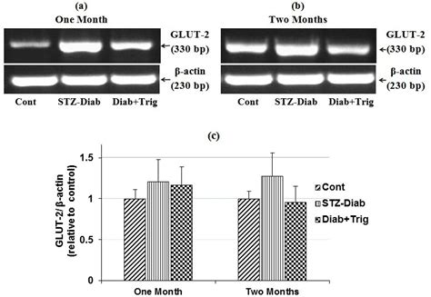 Rt Pcr Analysis Of Glut 2 Expression In Liver Tissues Data Of Control