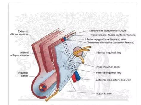 Surgical anatomy of inguinal hernia | PPT