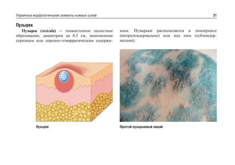 Иллюстрация 9 из 15 для Дерматовенерология. Атлас - Платонова, Бакулев ...