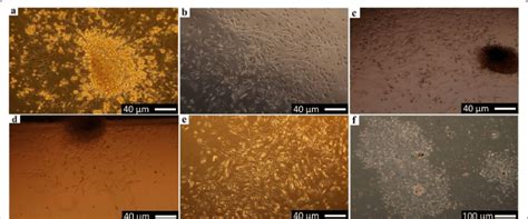 Inverted Phase Contrast Micrographs Show The Morphology Of Primary