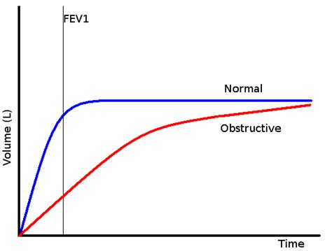 Restrictive vs Obstructive lung disease - almostadoctor