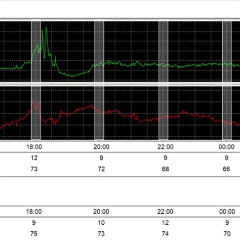 Graphic Classification Of High Intracranial Pressure Icp And Low