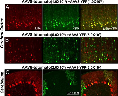 Intracerebroventricular Viral Injection Of The Neonatal Mouse Brain For