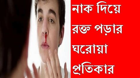 নাক দিয়ে রক্ত পড়ার ঘরোয়া প্রতিকার Youtube