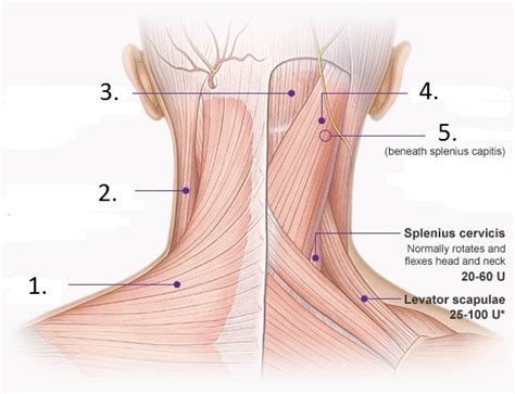 Posterior Neck Muscles Diagram | Quizlet