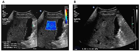 Diagnostics Free Full Text Comparison Between Two Dimensional And