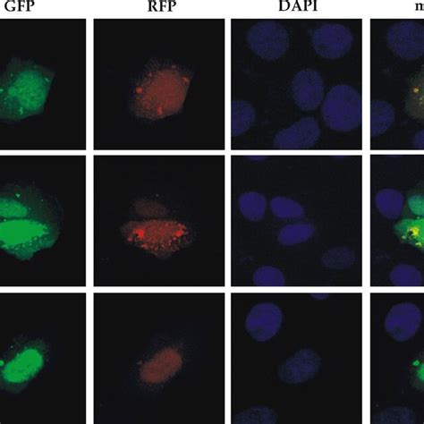 Nitric Oxide Inhibits Autophagy In Hepg Cells Monomeric Green