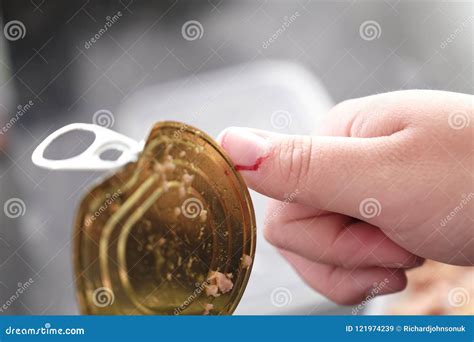 Cut Finger With Tin Can Lid Close Up Domestic Accident Concept Stock