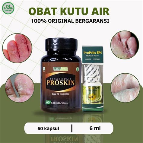 Jual Propolis SM Obat Kutu Air Salep Kutu Air Di Tangan Di Kaki