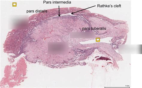 Histology - Endocrinology - Pituitary Gland Diagram | Quizlet