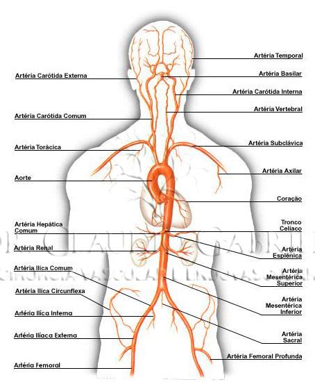 Angioplastia De Membros Inferiores Dr Claudio Gabriele Cirurgia