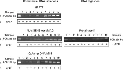 Conventional Pcr And Quantitative Real Time Pcr Qpcr Analysis Of Dna