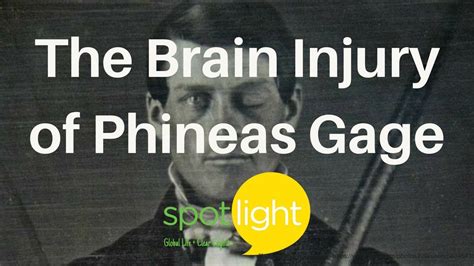 The Brain Injury Of Phineas Gage Practice English With Spotlight