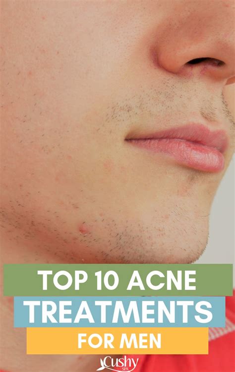 Best Acne Treatment For Men 10 Options Based On Science Cushy Spa