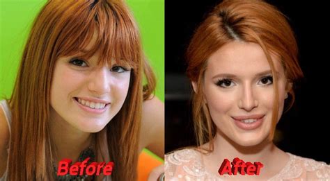 Bella Thorne Nose Job Before And After