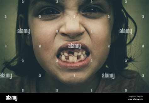 Missing Toothless Mouth Hi Res Stock Photography And Images Alamy