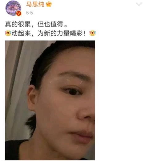 斯琴高娃打羊胎素！女星為美：沈夢辰臉上塗痔瘡膏，寧靜扎900針 每日頭條