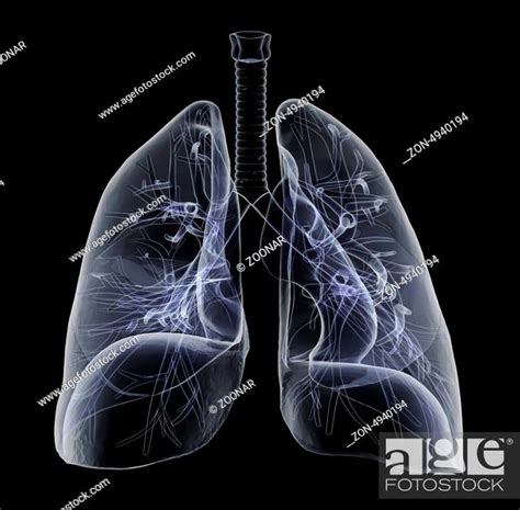 X-Ray of human Lungs, Stock Photo, Picture And Rights Managed Image ...