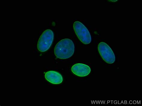 Lamin A C Fusion Protein Ag Proteintech