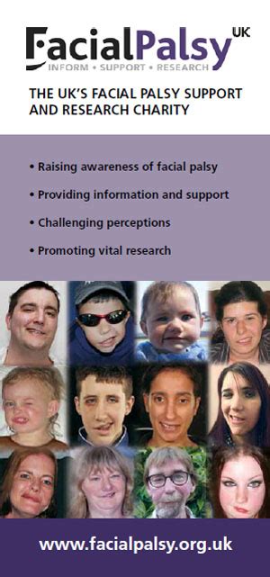 Facial Palsy Uk August Newsletter Facial Palsy Uk