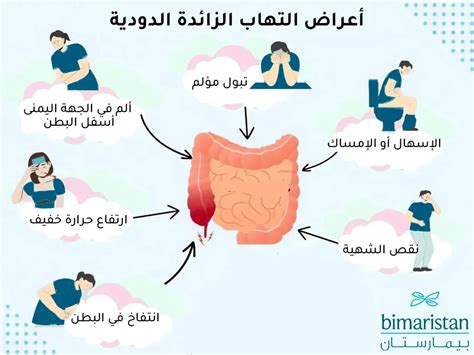 التهاب الزائدة الدودية البسيط الأعراض والعلاج بيمارستان