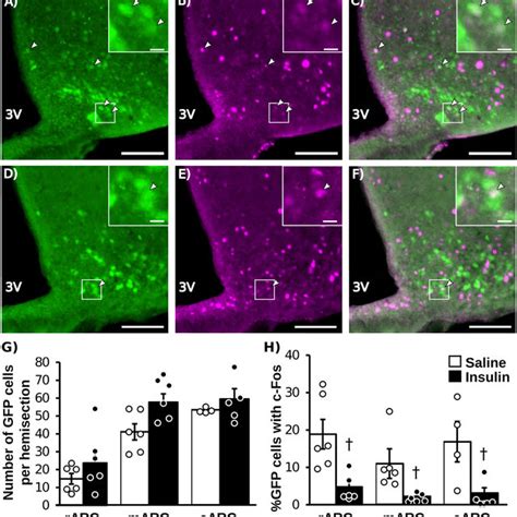 Representative Photomicrographs Of Dual Labeled Kiss1cregfp And C Fos Download Scientific