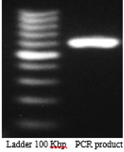 agarose gel electrophoresis left dna ladder kbp  bacterial