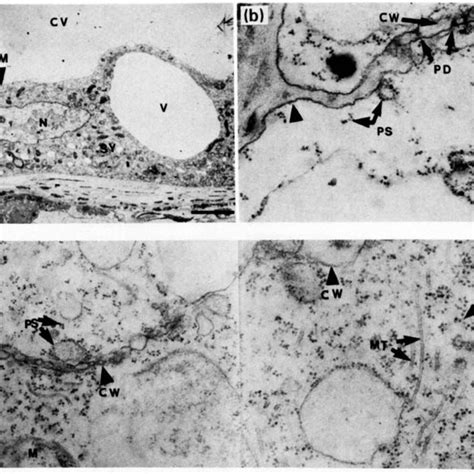 Transmission Electron Micrographs Of Wild Type Endosperm Syncytium And