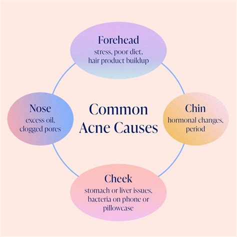 facial acne mapping  forehead cheeks chin  nose ps beauty