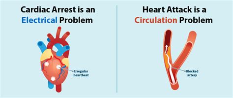 Heart Attack Vs Cardiac Arrest