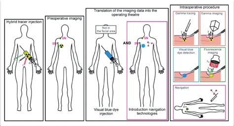 Hybrid Tracers For Sentinel Node Biopsy Pdf Download Available