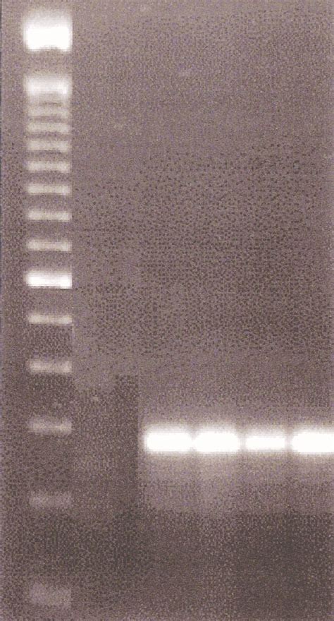 Agarose Gel Electrophoresis Of Pcr Amplification Products Lane 1 100