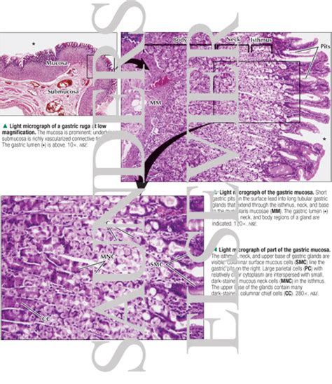 Stomach Histology Rugae