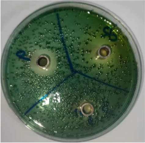 Oxford Cup Bacteriostatic Test Download Scientific Diagram