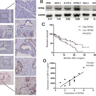 GFRAL Is Overexpressed In Pancreatic Cancer Tissues And Pancreatic