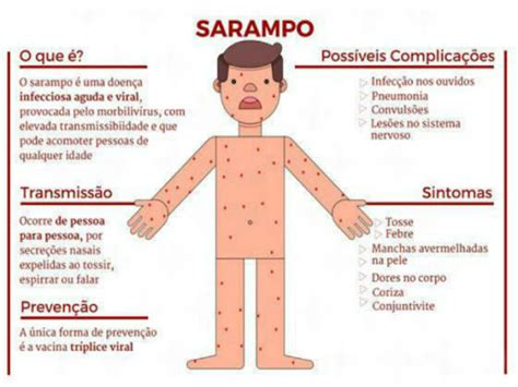 Sarampo Coça? Conheça As Fases E Sintomas Da Doença – UEUFA