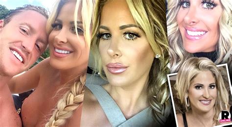 Real Plastic Kim Zolciak S Full Face Lift Revealed By Top Plastic Surgeons 10 Transformative