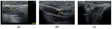 Applied Sciences Free Full Text Possibilities Of Ultrasound