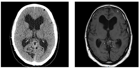 Edir European Diploma Of Radiology