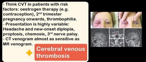 CEREBRAL VENOUS THROMBOSIS