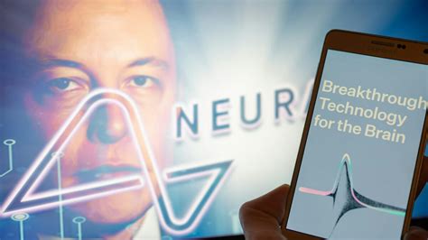 Elon Musk’s Neuralink Implants Chip Into Brain Of First Human Subject