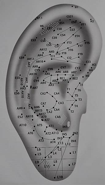 Regi Es Da Orelha E A Acupuntura Wiki Acupuntura