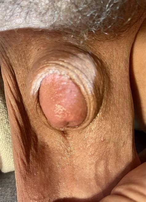 Tiny We We Micro Cock Nude Pics XHamster