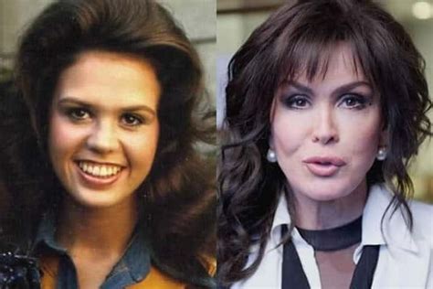 Marie Osmond Without Makeup - Celebrity In Styles