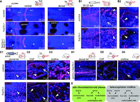 Foxj1a And Foxj1b Play Diverse Roles In The Formation Of Motile